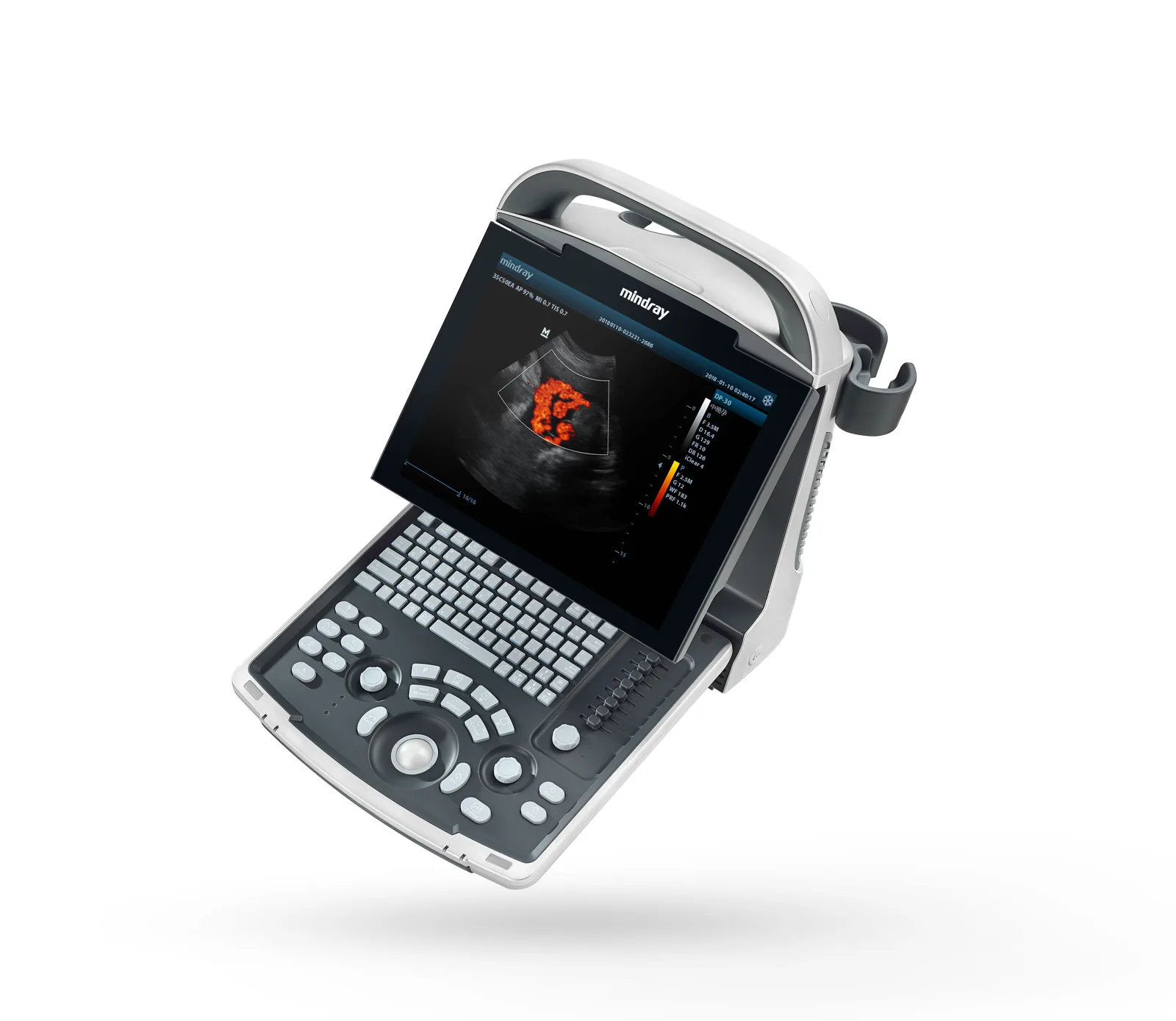Mindray DP-30Vet Портативный черно-белый УЗИ аппарат — фото 3