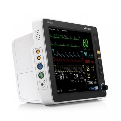 Мониторинг пациента